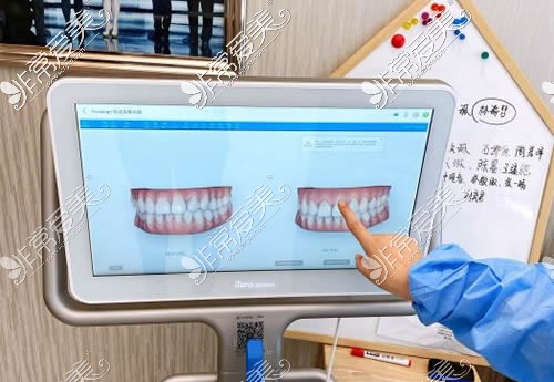 北京劲松口腔牙齿检查实拍图