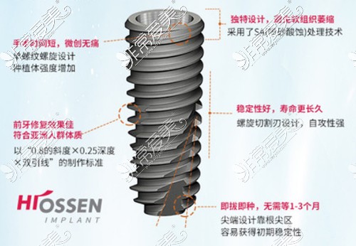 Hisson种植牙特点