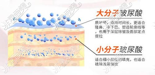 大小分子玻尿酸注射層次