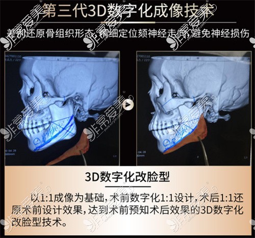 武汉能做下颌角的医院该选谁?亚韩、华美与中翰各有千秋!