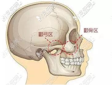 颧骨区和颧弓区示意图