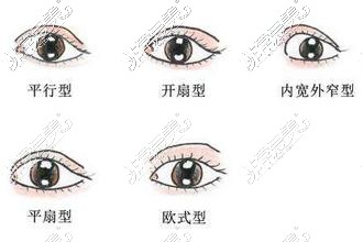 双眼皮款式