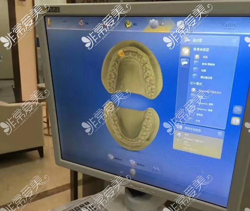 瓷睿刻修复是什么