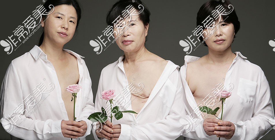 韩国隆胸手术医生玉在镇口碑真不错!看玉在镇隆胸手术特点!