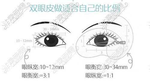 双眼皮改善标准示意