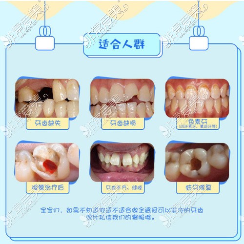 适合使用牙冠的情况