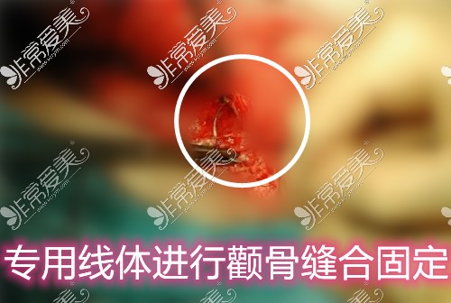 重庆华美潘宝华轮廓线体实拍