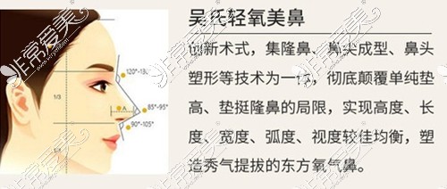 昆明鼻综合去哪做谁做比较好?文章介绍满意度高的医生名单!