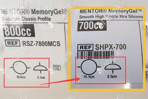 曼托隆胸假体型号