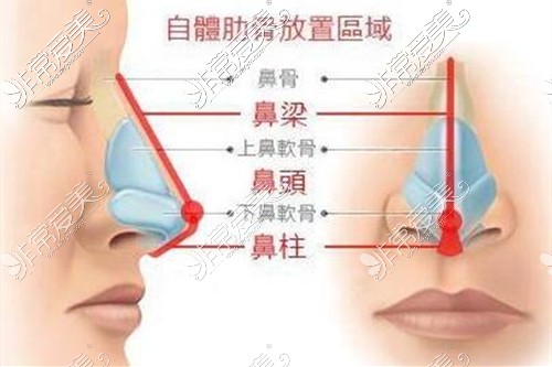 自体软骨鼻分布图示