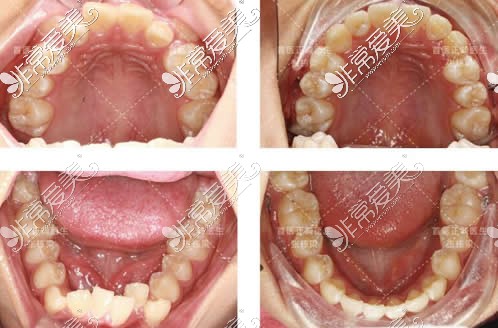 北京禾禾齿科牙齿矫正真人<span style=