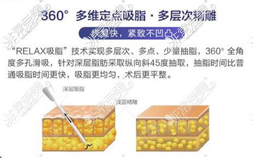 美莱潘卫峰吸脂怎么样,多少钱?是长沙做吸脂好的医生吗?