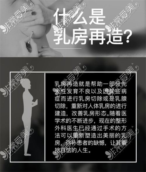 乳房再造介绍图