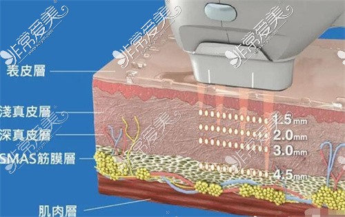 7d聚拉提原理