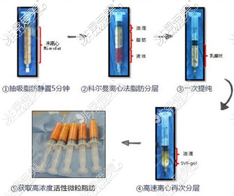 5+2分離式活性萃取圖示