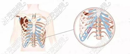 肋骨鼻综合一般多少钱左右？价格5万到底算不算贵？