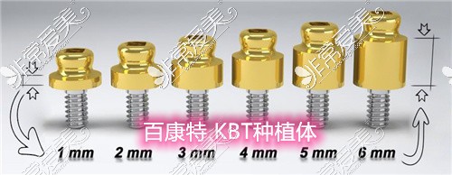 百康特 KBT种植体