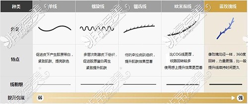 做埋线提升能保持多久？面部埋线提升一生能做几次？