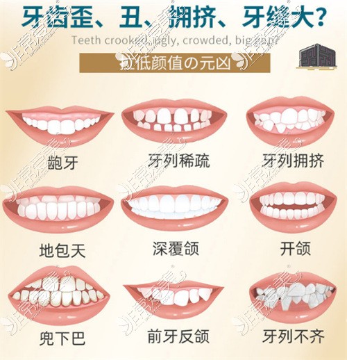 需要进行牙齿矫正的情况