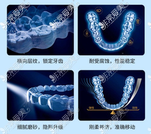 隐形牙套特性及优势