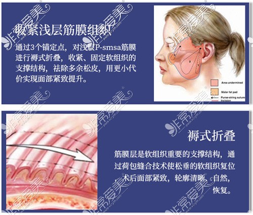 南京拉皮手术比较好的医院有哪些?拉皮手术价格是多少?