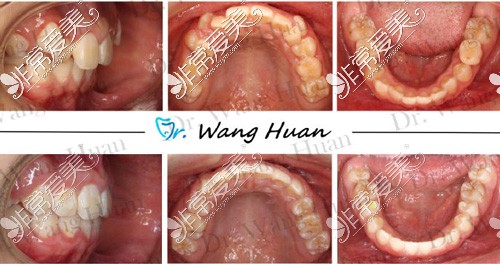 厦门正畸王欢怎么样?细数学霸王欢博士正畸技术到底多牛!