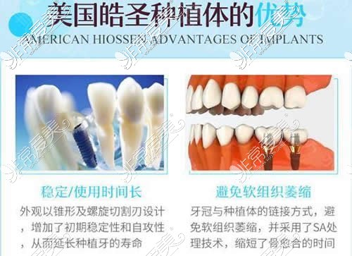 美国皓圣种植牙价格贵不贵，和诺贝尔种植体哪个好？