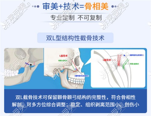 西安磨骨手术多少钱？这家医院削骨瘦脸的价格真心实惠！