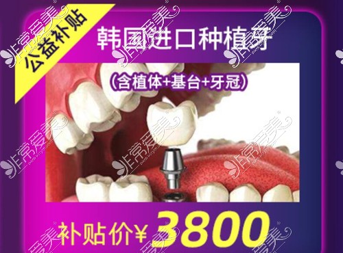 北京圣贝618活动进口种植牙3800元