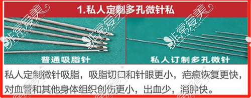 武汉艺星抽脂效果怎么样?武汉艺星抽脂医生杨斐技术厉害吗!