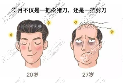 年轻人受脱发问题困扰