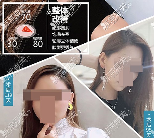 大连星妍整形医院怎么样?是正规医院吗?口碑和特色告诉你