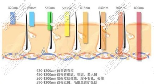 哈尔滨光子嫩肤多少钱一次?看哈尔滨正规医院光子嫩肤价格