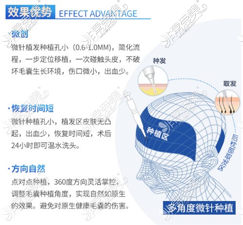 西安治疗斑秃好医院公布，告诉你西安看斑秃哪家医院好！