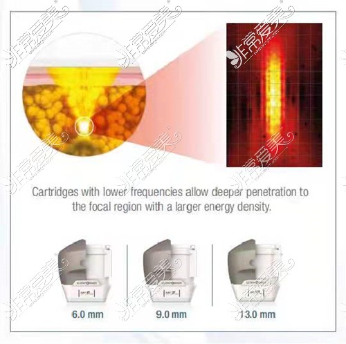 7D聚拉提用于身体的3个探头