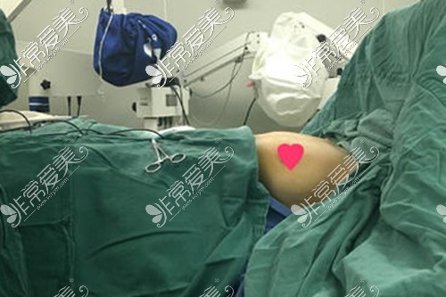 昆明正规隆胸医院排行，当地求美者都在这几家进行丰胸!