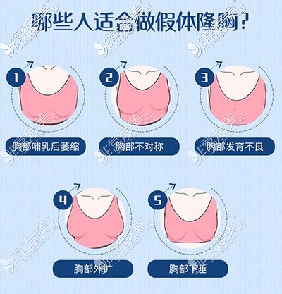 哪些人适合做隆胸手术