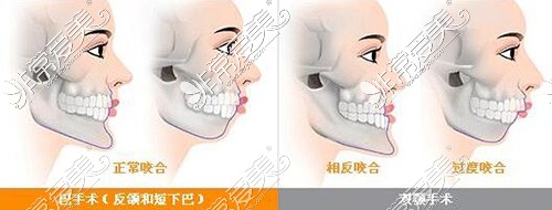 面部凸嘴卡通照片