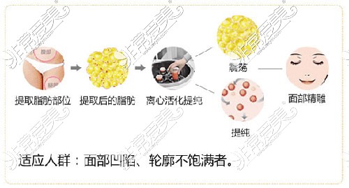 徐州脂肪填充哪个医生好?分享徐州自体脂肪填充有名的医生!