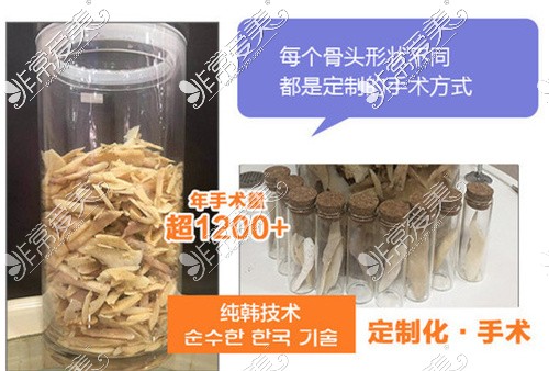 重庆下颌角手术哪里做得好?盘点5家热门轮廓医院附价格表!