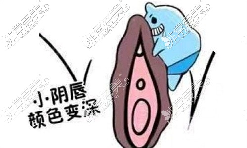 小阴唇变色漫画