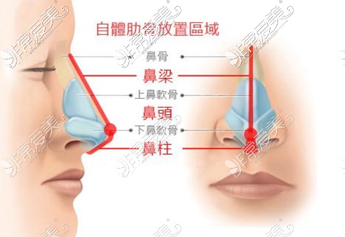 肋骨鼻示意图