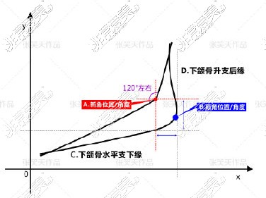 北京圣嘉新医疗美容医院张笑天下颌角设计