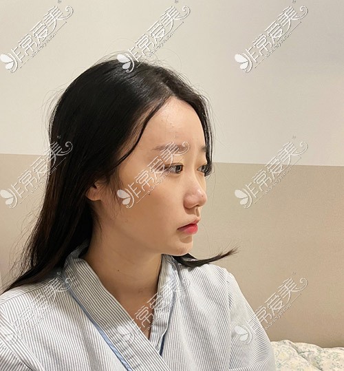 韩国优雅人肋骨鼻照片