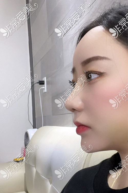 韩国优雅人整形医院肋骨鼻