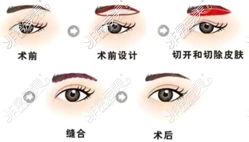 眼综合在金华收费竟然这么少？好医生原来并不贵！