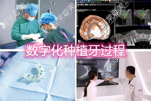武汉种牙的价格一般都是多少钱?这5家医院种植牙价格实惠!