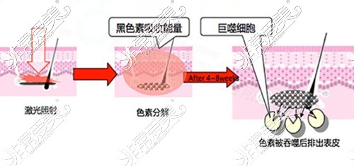 祛斑原理流程图