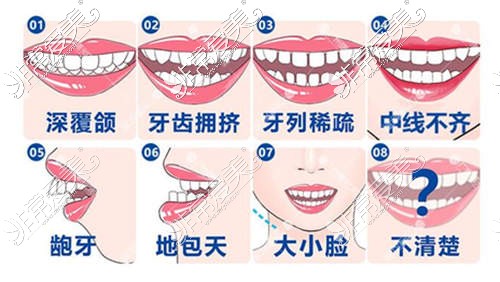 广州隐形矫正牙齿哪里好？隐形矫正牙齿多少钱