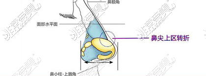 南昌艾莱芙隆鼻怎么样费用多少?艾莱芙隆鼻优势及价格详解!